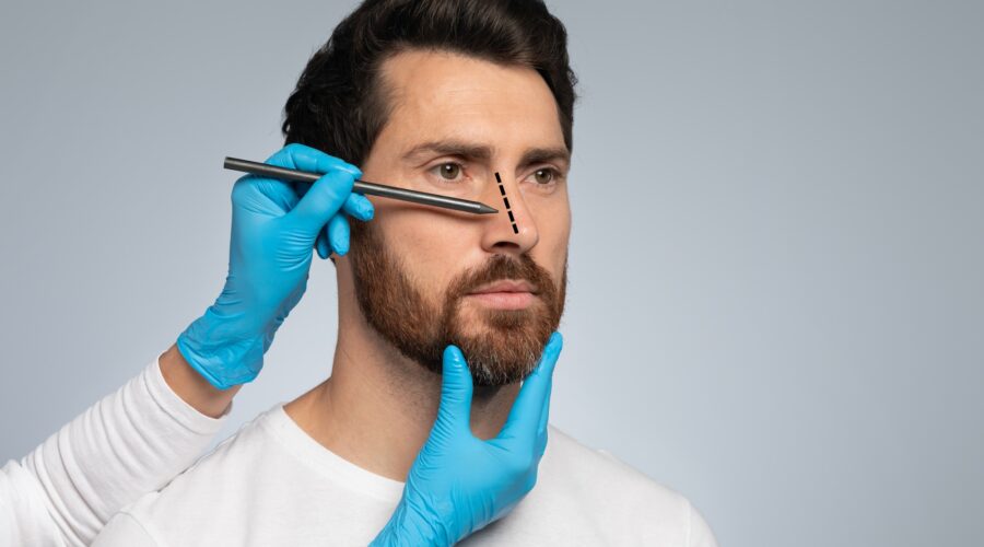 rhinoplastie