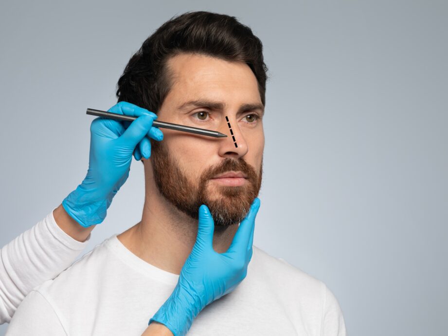 rhinoplastie
