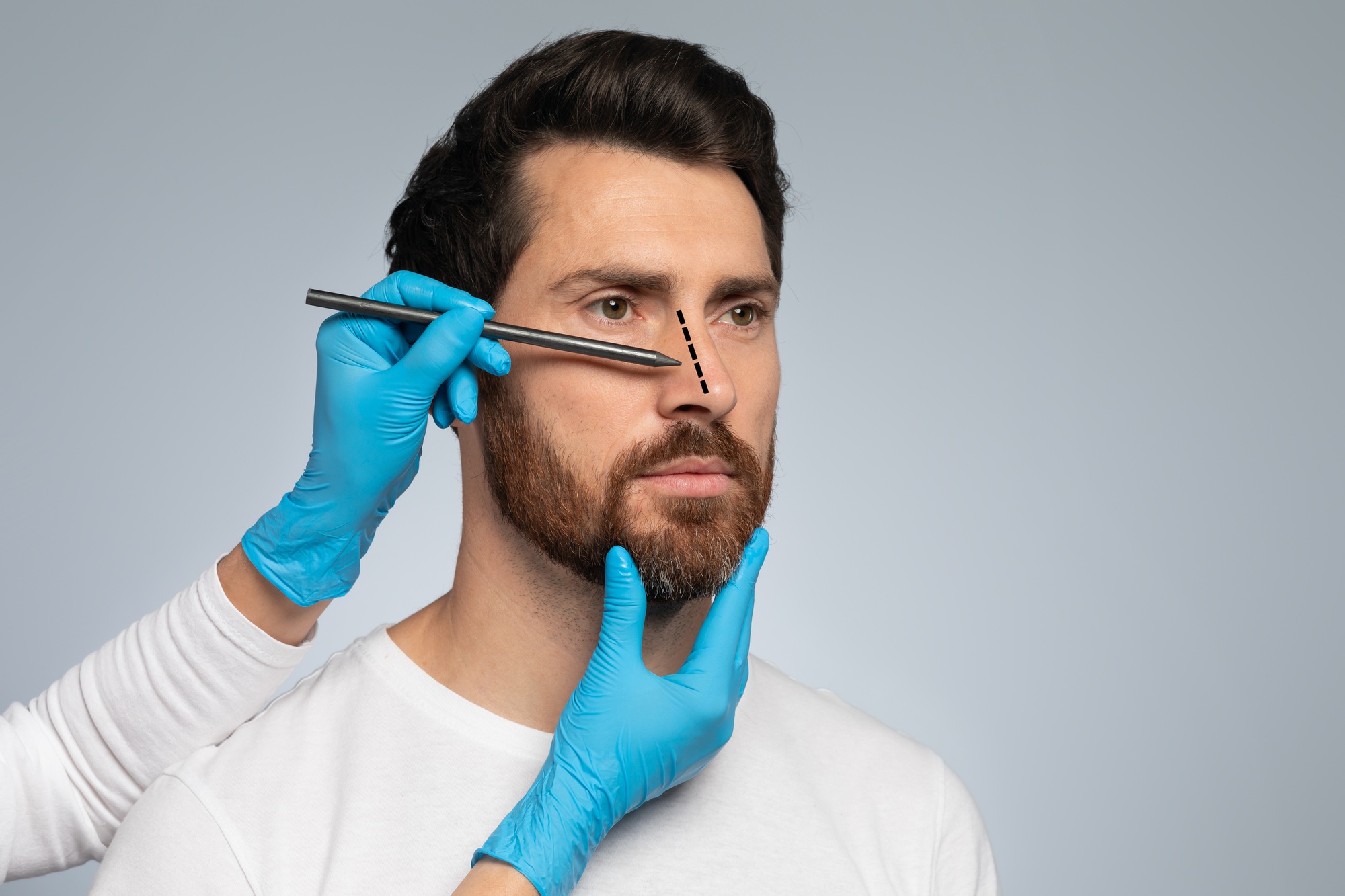 rhinoplastie